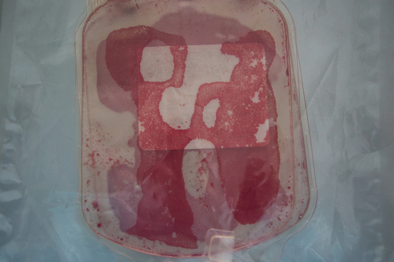 Опустевшая капельница. 